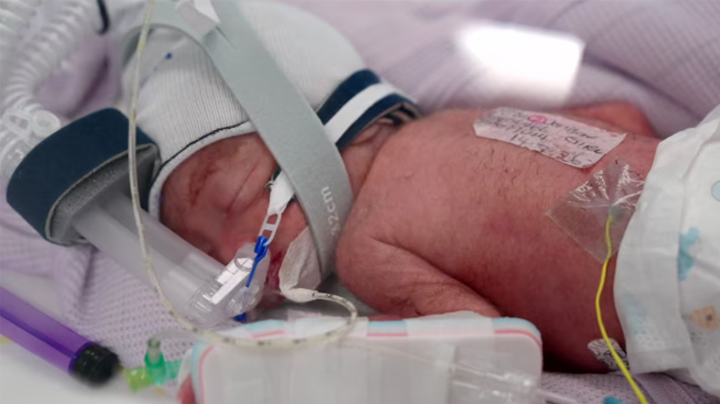 One of Jenitar Na'amoana's quadruplets. (Source: Metro Health North)