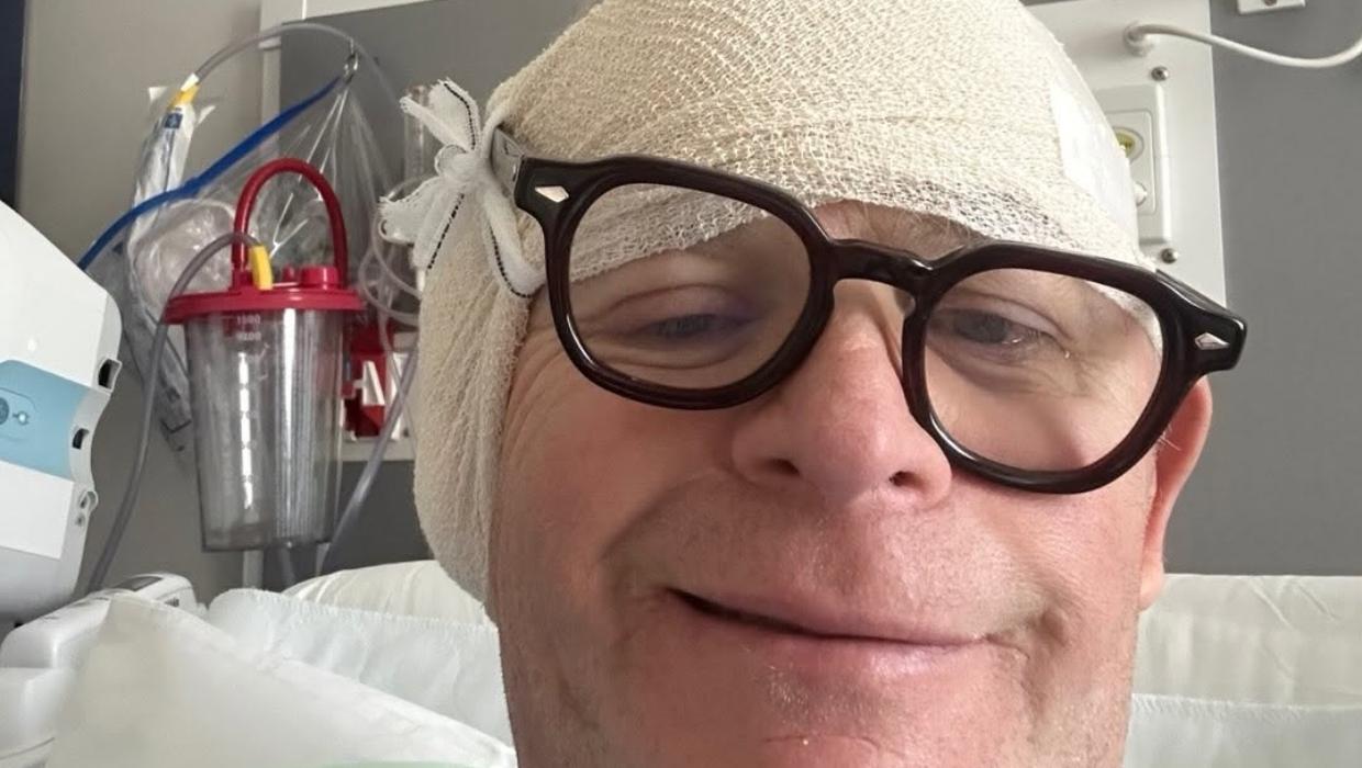 Brown had a second surgery on his ear to treat his aural exostoses.