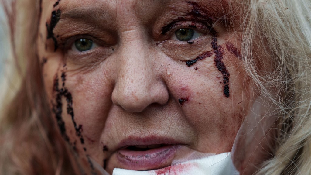 An injured Olena Dniprovska sits in the yard of her house damaged after a Russian strike in Kyiv, Ukraine, on Tuesday, June 2, 2026.