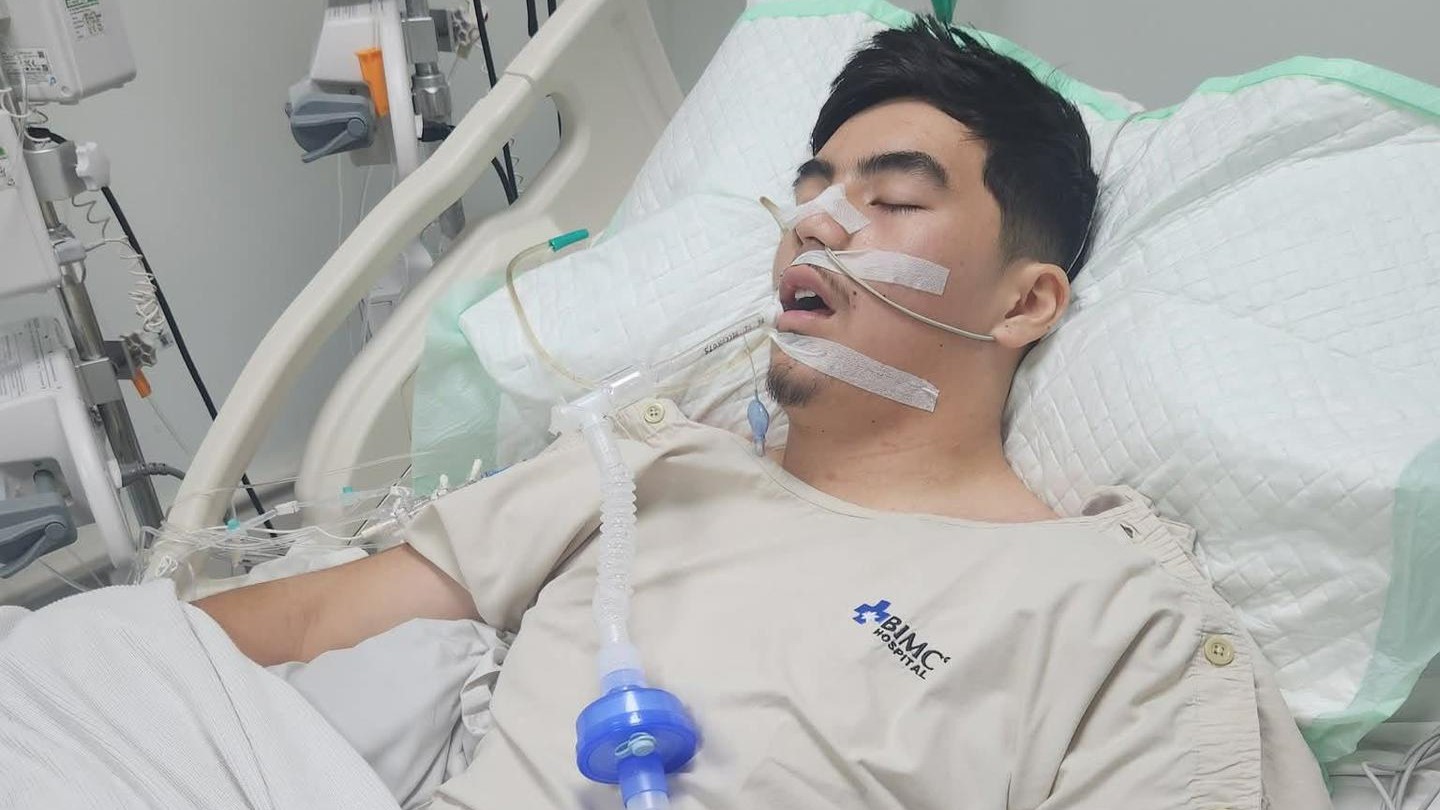 Ashen Phaipanya was intubated and sedated at a Bali hospital.